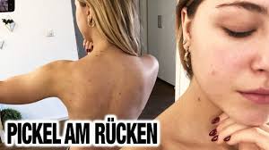 Mein Alltag In Koln I Sport Pickel Am Rucken Youtube Youtube
