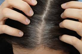 Can you dye grey hair with it so laser may remove it? Does Electrolysis Work On White Or Gray Hair Stylecheer Com
