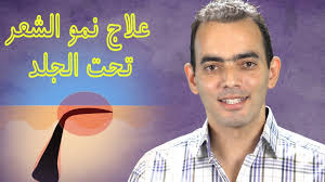 علاج نمو الشعر تحت الجلد Youtube