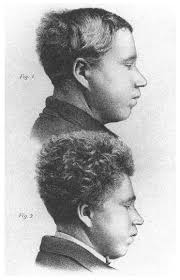 Hysteria Beyond Freud