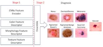 The strongest risk factor for developing skin cancer is ultraviolet (uv) ray exposure, typically from the sun. Https Www Biorxiv Org Content 10 1101 382010v1 Full Pdf
