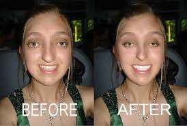 フォトショ詐欺 衝撃のビフォーアフター写真 ここまで綺麗になれるのか ページ 2 ailovei フォトショ 写真 詐欺