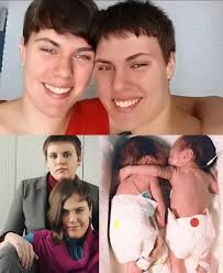 Mother's love for twins with down syndrome