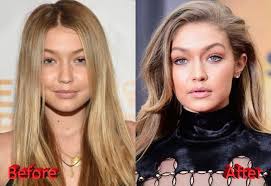 Gigi hadid gushes over birthday gift from bf zayn malik. 03 23 18 Gigi Hadid Plastic Surgery Before And After Postimages