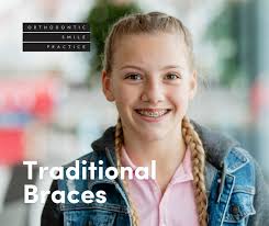 Orthodontic Smile Practice