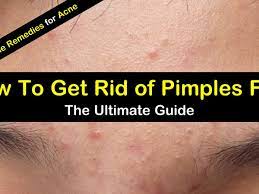 8 Great Home Remedies To Get Rid Of Pimples Fast