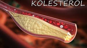 Hasil gambar untuk obat kolesterol ampuh