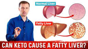 They are concrete measurements of progress what should your ketone level be? Does Keto Diet Affect Liver Enzymes