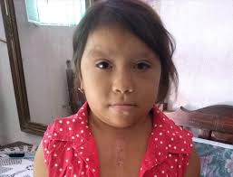 NIÑA DE APENAS 8 AÑOS DE EDAD DE SAN MIGUEL EL QUEMADO MUNICIPIO DE  SANTIAGO IXCUINTLA NECESITA DE LA AYUDA DE TODAS LAS PERSONAS DE BUEN  CORAZÓN 🙏‼️ Buenas tardes amigos y