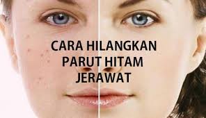 Parut kunyit hingga halus, bisa juga anda menggunakan blender. Emma Nurraysa Assalamualaikum Dan Selamat Malam Tips Facebook