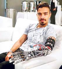 iki bilgisayar muhendisimiz semih celik ve erdem tatli yapay zeka ile hareketleri ogrenen normal kol ve el gibi calisan akilli protez uretti paralimpik milli