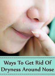 Pin By Ausencio Villarreal On Tips Dry Nose Skin Dry Flaky Skin Dry Skin On Face