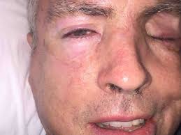 Fundraiser by Jessie Hubbard : Support Steve Hubbard Get better