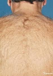 We offer a wide variety of services such as laser hair removal, coolsculpting, broad band light, ultherapy, and injectable services such as botox, lip fillers and many more. Laser Hair Removal Fairfield County Connecticut