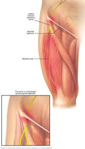 The adductor muscles form the fleshy mass on the medial side of the thigh. Meralgia Paresthetica Symptoms And Causes Mayo Clinic