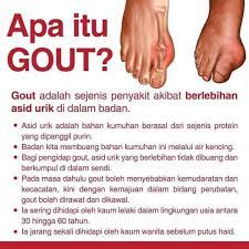 Produk kesihatan dan kecantikan.murah murah!!! Punca Gout Penyakit Gout Ini Aloeveraflp Munirah Facebook