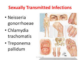 Sexually Transmitted Infections Basics In Diagnosis