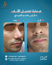 عيادة د.فراس جاسم العبيدي اختصاص الأنف والأذن والحنجرة وتجميل الأنف