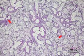 Pet owners will first notice a sebaceous cyst when they discover a raised bump on their dog's skin. Pdf Canine Sebaceous Adenoma Of External Genitalia Case Report Semantic Scholar