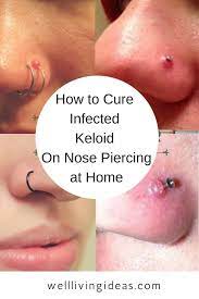 Pin On Nose