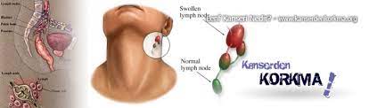 Vücudumuzda bulunan binlerce lenf bezi, enfeksiyon ve hastalıklara karşı direnmemizi sağlayan bağışıklık sisteminin en önemli parçasıdır. Bu Hastalik Sizdede Olabilir Lenf Kanseri Konuyu Okuyunuz