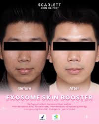 Scarlett Skin Clinic+ Bekasi (@scarlettskinclinic.bekasi) • Instagram  ဓာတ်ပုံများနှင့် ဗီဒီယိုများ