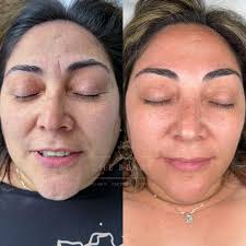 The Beauty Factory Chile (@thebeautyfactory.cl) • Instagram photos and  videos