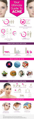 Your Ultimate Guide To Acne Acne Infographic Health Acne Causes