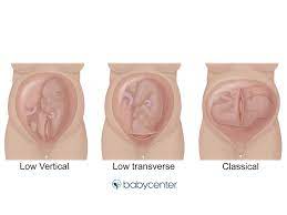 31 Weeks Pregnant Symptoms Signs Babycenter