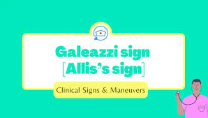 Image result for Galeazzi Sign