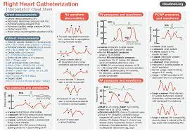 Right Heart Catheterization Cheat Sheet Interpretation Heart Catheterization Cardiac Nursing Cheat Sheets Central Venous Pressure