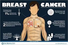 Can breast cancer be fibro adenoma? Male Breast Cancer Awareness Jabrushblog