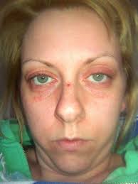 Alison Hobson (@97312d26e7b7447)