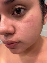 What is a good moisturizer for hydration and pore minimization?