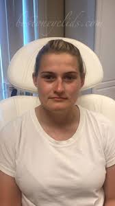 Kendra Lyons, PA-C (@bostoneyelids_pa) · Wellesley, MA