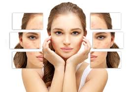 How To Remove Pimple Marks From Face Makeupandbeauty Com how to remove pimple marks from face