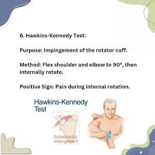 Image result for Rotator Cuff Triad Test