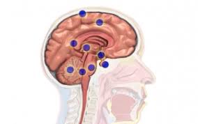 Salah satu jenis penyakit berbahaya yang harus diwaspadai adalah tumor otak. Jangan Dianggap Enteng 8 Gejala Ini Bisa Jadi Indikasi Tumor Otak