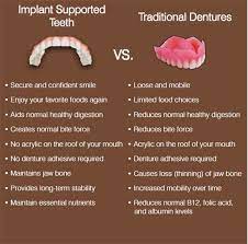How much implant supported dentures cost. Best Dentist In Pune Aundh Dental Clinic Services In Baner Pimpri Chinchwad Affordable Dental Affordable Dental Care Dental Clinic