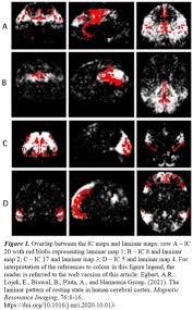 BNA 2021 Festival of Neuroscience Poster abstracts, 2021