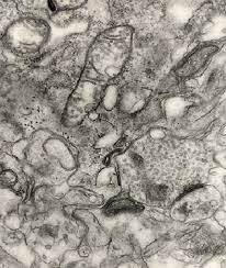 Alterations Of Mitochondria And Golgi Apparatus Are Related To Synaptic Pathology In Alzheimer S Disease Intechopen