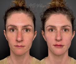 Melissa Tilley, NP (@np_melissa) · Instagram photos and Reels