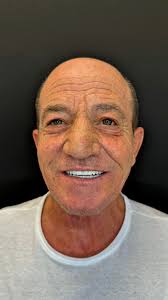 Our patient Ramona is very happy with the result she has received from our  clinic. @dent.italia Her brilliant smile shows the excellent work done by  our doctors.🦷✨