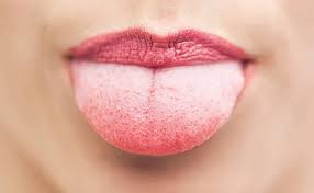 Weisse Wunden Im Mund Oder Leukoplakie Dr Jamilian