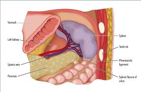 Image result for Splenomegaly