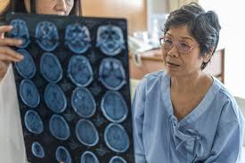 Most primary brain tumors begin from glial cells in the brain and are called gliomas. May Is Brain Cancer Awareness Month