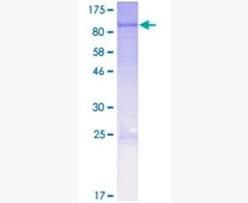 Recombinant Human Cpt2 Protein Ab114539 Abcam