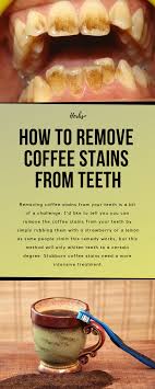 In addition to brushing your teeth regularly, which may not work as well as you would like, check below the best ways to remove coffee stains from. Pin On Teeth
