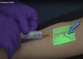 Maybe you would like to learn more about one of these? Vein Viewer Visualizing Veins In Real Time