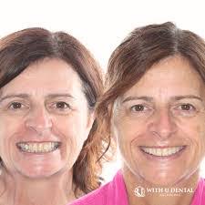 Ron Dorst's Instagram, Twitter & Facebook